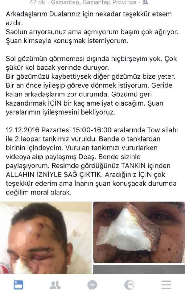 "Bir gözü kaybettiysek diğeri bize yeter" - Resim : 1
